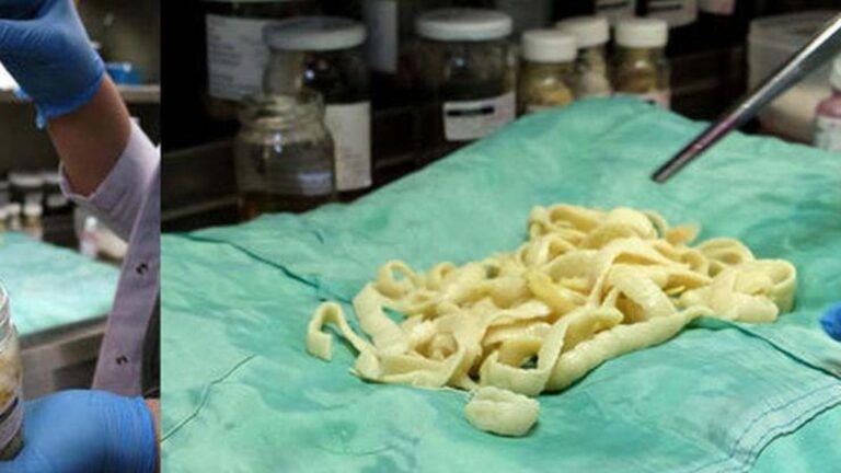 Özel olan nedir? Tenya nasıl ödenir, tenni nasıl tedavi edilir?